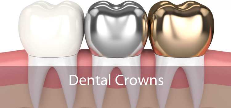 Dental Crowns 